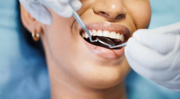 Best Emergency Root Canal Treatment in Greenbriar, VA